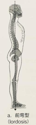 理学療法士が語る 自分の姿勢パターンに合ったケアの方法【ロルドーシス（でっ尻胸ペタさんタイプ）編】